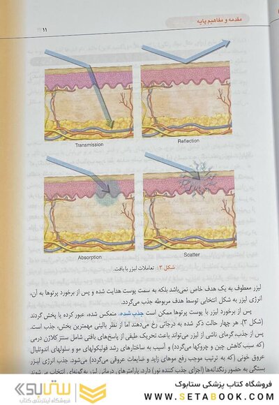 راهنمای کاربردی لیزر درمانی زیبایی