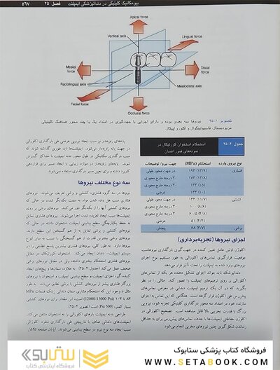 ایمپلنت دندانی میش 1 و 2