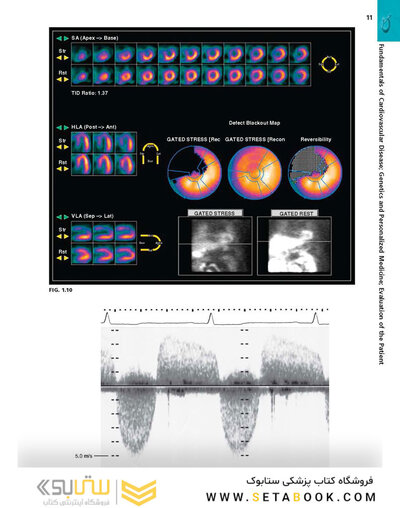 BRAUNWALD'S HEART DISEASE 2019