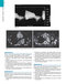 BRAUNWALD'S HEART DISEASE 2019