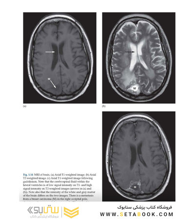 Diagnostic Imaging Armstrong 7th Edicion  2013