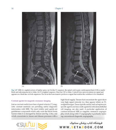Diagnostic Imaging Armstrong 7th Edicion  2013