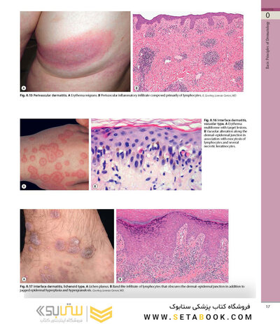 همراه باویدئو Dermatology Bolognia