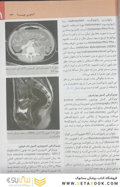 آناتومی گری برای دانشجویان تنه (جلد 1) 2020