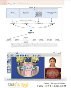 Principles and Biomechanics of Aligner Treatment