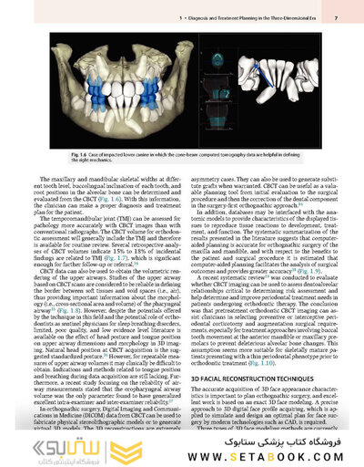 Principles and Biomechanics of Aligner Treatment