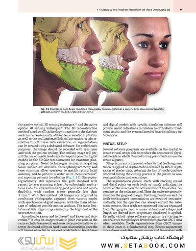 Principles and Biomechanics of Aligner Treatment