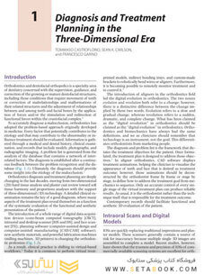 Principles and Biomechanics of Aligner Treatment
