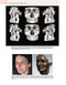 Principles and Biomechanics of Aligner Treatment