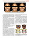 Principles and Biomechanics of Aligner Treatment