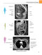 Gray's atlas of anatomy