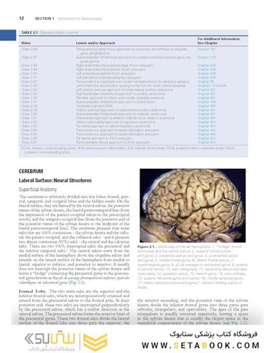 Youmans and Winn Neurological Surgery: 4 - Volume Set 2023