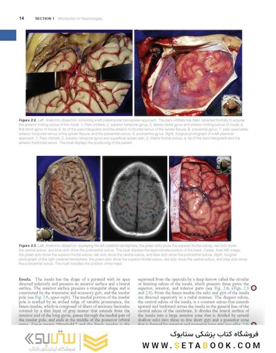 Youmans and Winn Neurological Surgery: 4 - Volume Set 2023