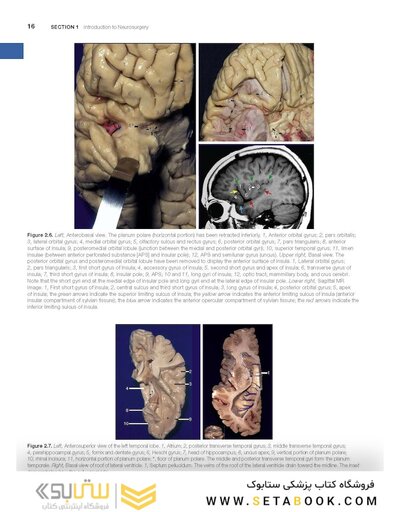 Youmans and Winn Neurological Surgery: 4 - Volume Set 2023