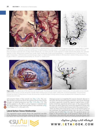 Youmans and Winn Neurological Surgery: 4 - Volume Set 2023