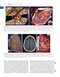 Youmans and Winn Neurological Surgery: 4 - Volume Set 2023