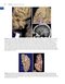 Youmans and Winn Neurological Surgery: 4 - Volume Set 2023