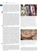 Youmans and Winn Neurological Surgery: 4 - Volume Set 2023