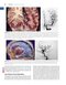 Youmans and Winn Neurological Surgery: 4 - Volume Set 2023