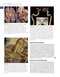 Youmans and Winn Neurological Surgery: 4 - Volume Set 2023