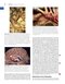 Youmans and Winn Neurological Surgery: 4 - Volume Set 2023