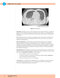 USMLE Step 2 CK Lecture Notes 2022: 5-book set