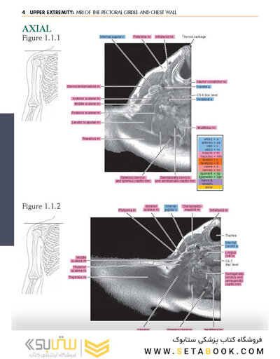 Sectional Anatomy by MRI and CT, 4th Edition2016