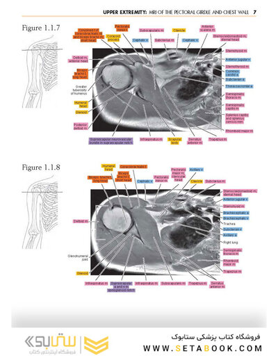 Sectional Anatomy by MRI and CT, 4th Edition2016