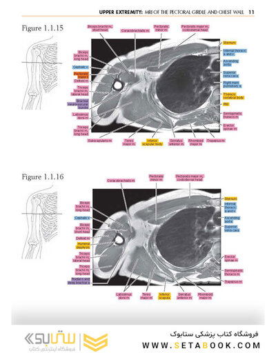Sectional Anatomy by MRI and CT, 4th Edition2016