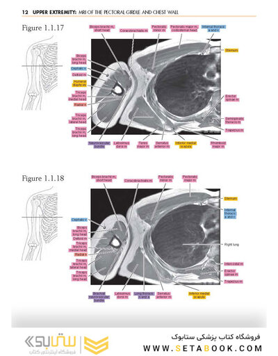 Sectional Anatomy by MRI and CT, 4th Edition2016