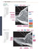 Sectional Anatomy by MRI and CT, 4th Edition2016