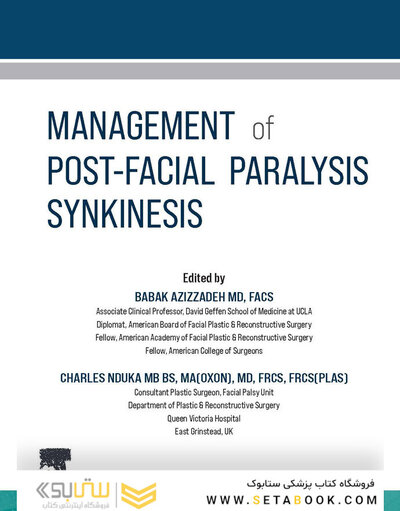 Management of Post-Facial Paralysis Synkinesis