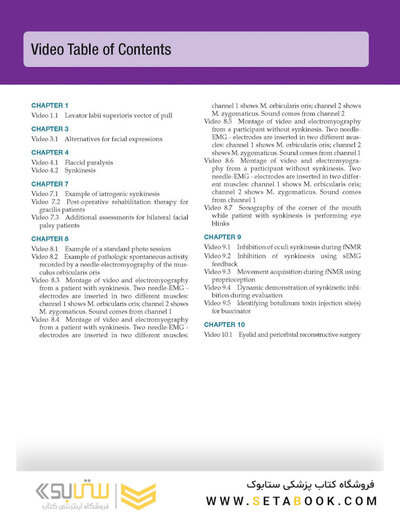 Management of Post-Facial Paralysis Synkinesis