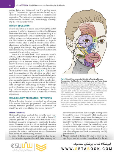 Management of Post-Facial Paralysis Synkinesis
