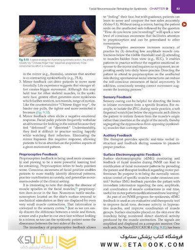 Management of Post-Facial Paralysis Synkinesis