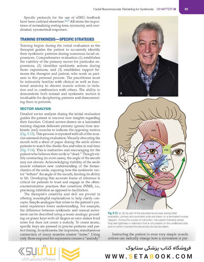 Management of Post-Facial Paralysis Synkinesis
