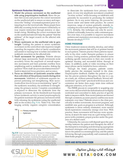 Management of Post-Facial Paralysis Synkinesis
