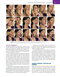 Management of Post-Facial Paralysis Synkinesis