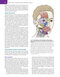 Management of Post-Facial Paralysis Synkinesis