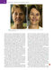 Management of Post-Facial Paralysis Synkinesis