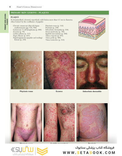 2021 Habif's Clinical Dermatology: A Color Guide to Diagnosis and Therapy 7th Edition