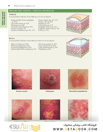 2021 Habif's Clinical Dermatology: A Color Guide to Diagnosis and Therapy 7th Edition