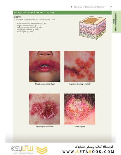 2021 Habif's Clinical Dermatology: A Color Guide to Diagnosis and Therapy 7th Edition