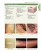 2021 Habif's Clinical Dermatology: A Color Guide to Diagnosis and Therapy 7th Edition
