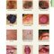 2021 Habif's Clinical Dermatology: A Color Guide to Diagnosis and Therapy 7th Edition