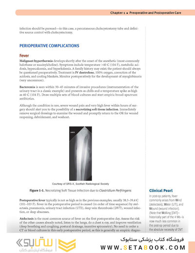 USMLE Step 2 CK Lecture Notes 2022: Surgery