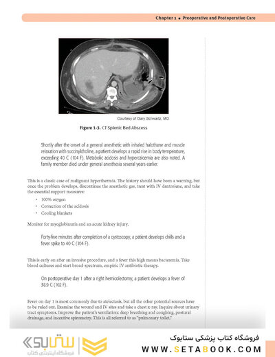 USMLE Step 2 CK Lecture Notes 2022: Surgery