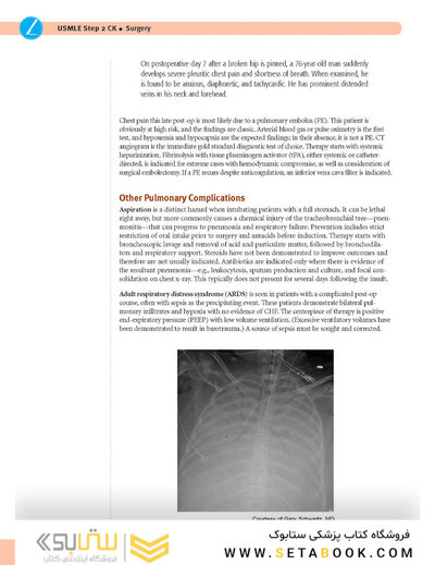 USMLE Step 2 CK Lecture Notes 2022: Surgery