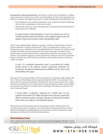 USMLE Step 2 CK Lecture Notes 2022: Surgery