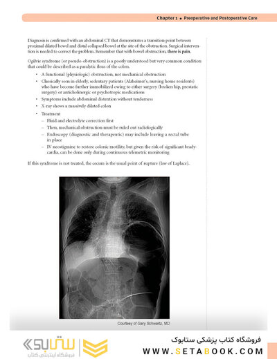 USMLE Step 2 CK Lecture Notes 2022: Surgery